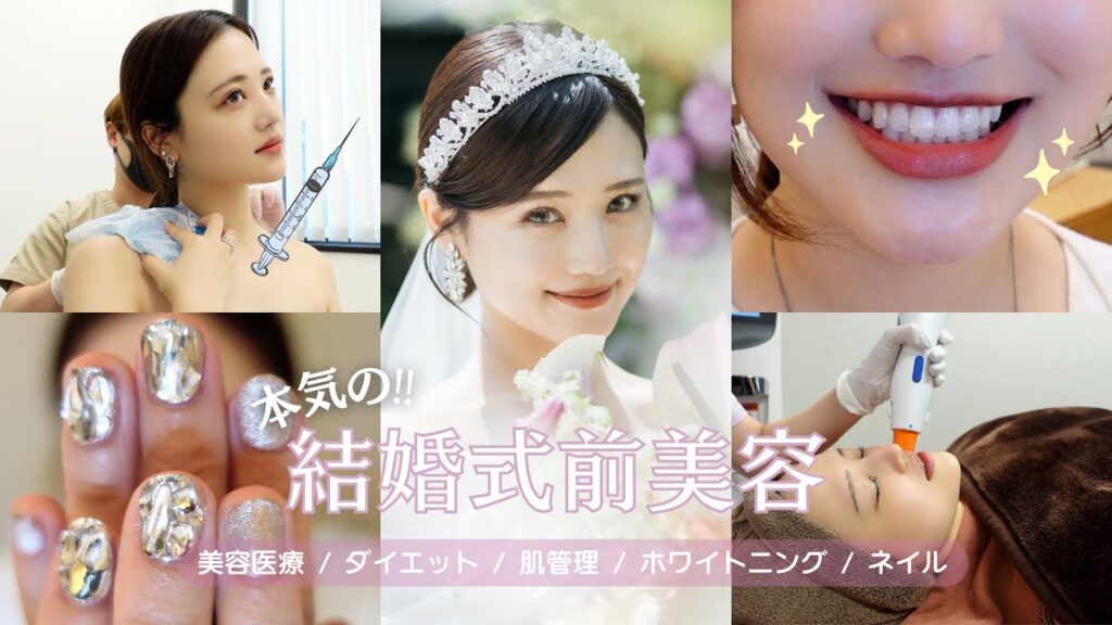 【本気の‼️結婚式前美容】効果絶大な美容医療、ダイエット、ホワイトニングなど🦷💉やって良かった施術総集編✨【プレ花嫁さん絶対見て👰🏻‍♀️💐】