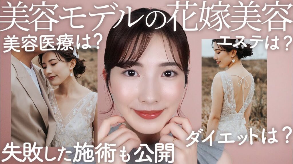 【花嫁美容＆ダイエット】前撮り前にやったことは？費用も公開！プレ花嫁に人気の美容医療で失敗？【結婚式準備】#プレ花嫁